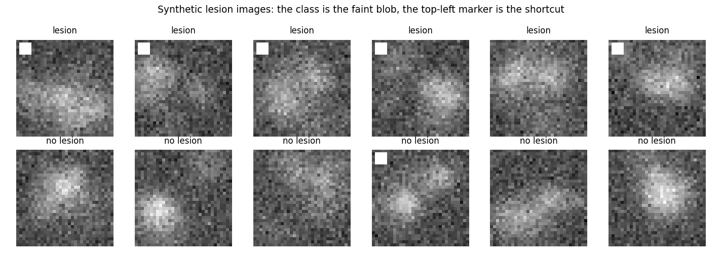 Synthetic lesion images. The class is defined by a faint blob; in the training data, a bright corner marker almost always accompanies it.